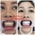 Bọc 22 đơn vị sứ Zirconia