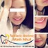 Nha khoa thẩm mỹ tại Nha khoa Minh Nhựt