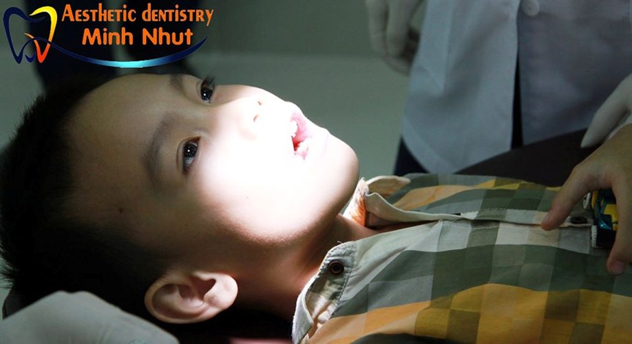 Nhổ răng sữa tại Nha khoa Minh Nhựt