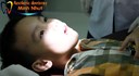 Nhổ răng sữa tại Nha khoa Minh Nhựt