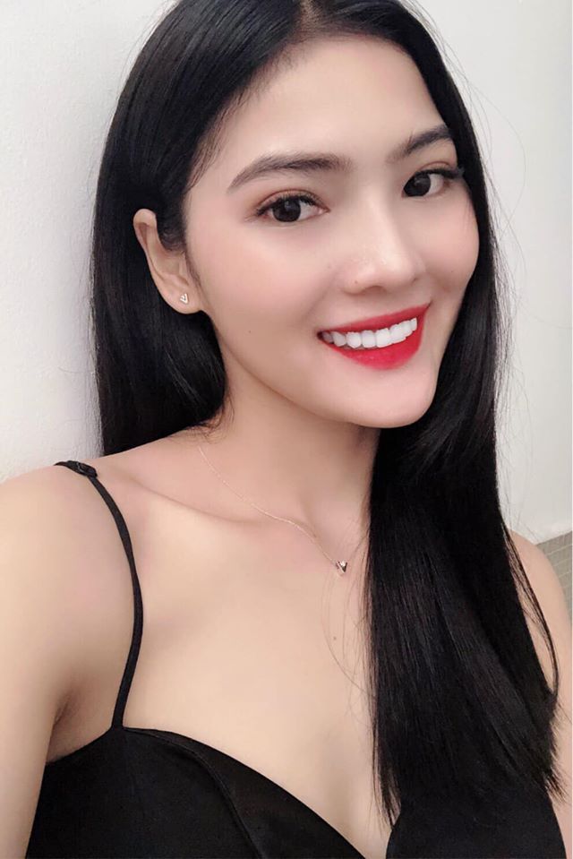 Thẩm mỹ toàn sứ kết hợp cắt nướu điều trị cười hở nướu dứt điểm
