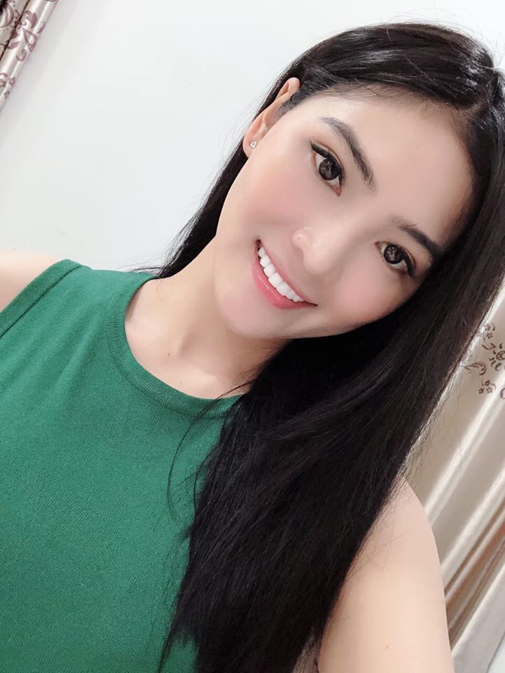 Thẩm mỹ toàn sứ kết hợp cắt nướu điều trị cười hở nướu dứt điểm